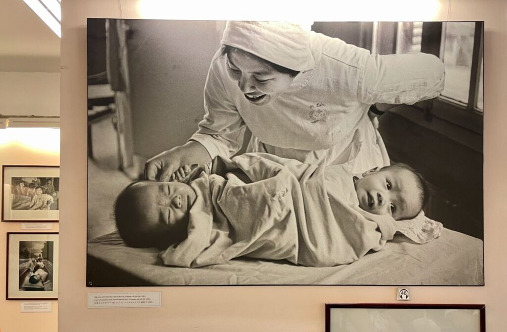 Fotografia dei gemelli Viet e Duc Nguyen che mostra gli effetti a lungo termine dell’Agente Arancio